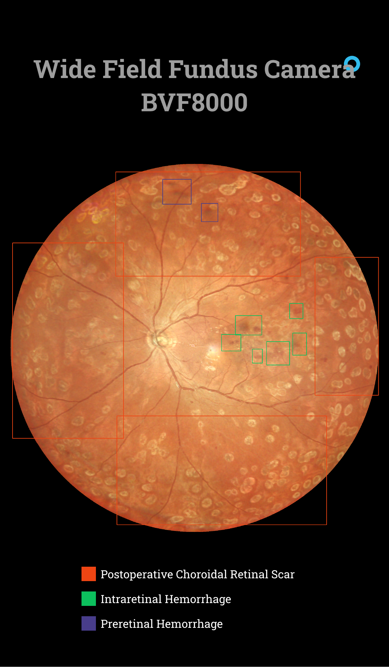 Wide field system BVF8000