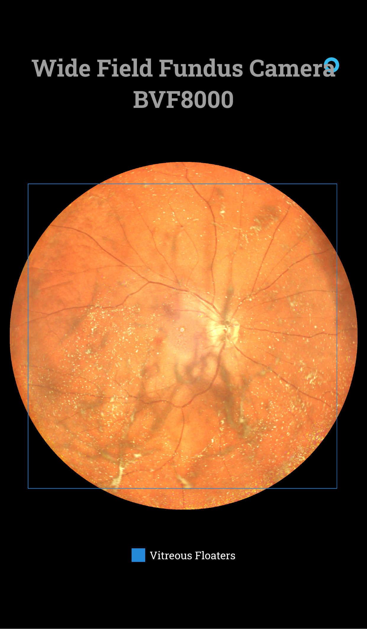 Wide field system BVF8000